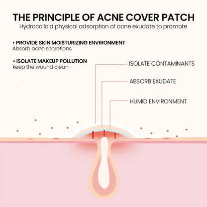 Star Acne Patches Invisible Pimple Dots for Blemishes