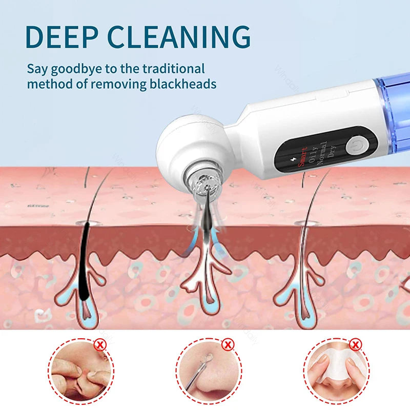 Hydrating Blackhead Remover Pore Vacuum With Hot Compress
