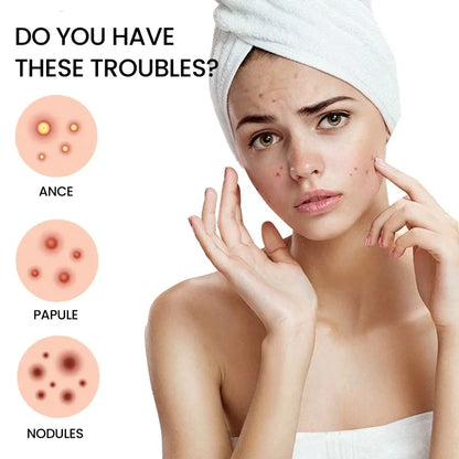 Star Acne Patches Invisible Pimple Dots for Blemishes
