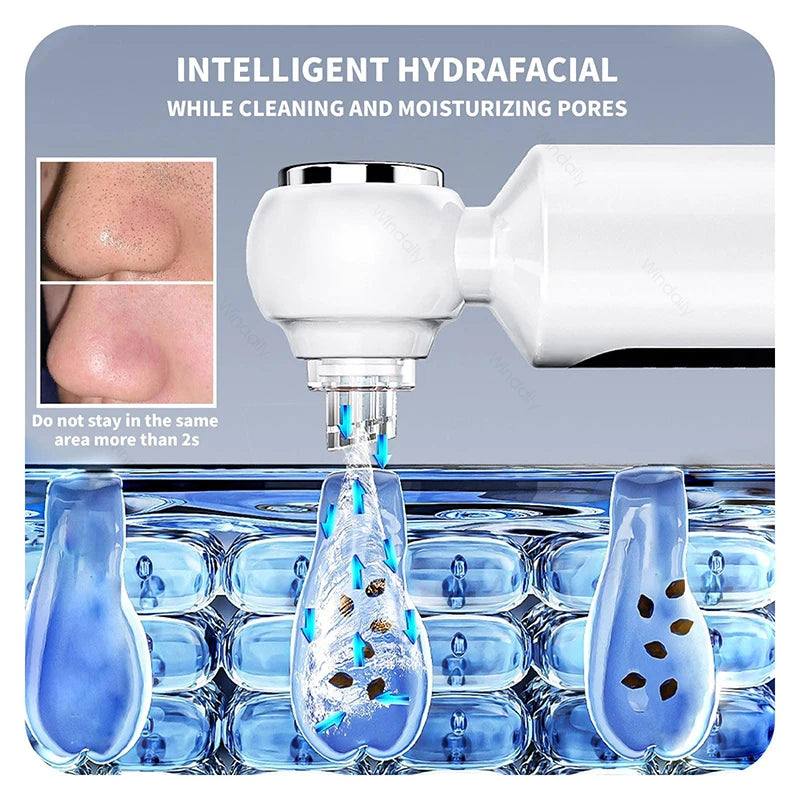 Hydrating Blackhead Remover Pore Vacuum With Hot Compress